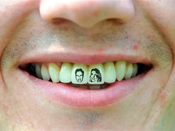 چینیوں میں دانتوں پر ٹیٹو بنوانے کا فیش مقبول ہونے لگا