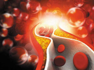 ہائی کولیسٹرول: خاموش خطرہ جس سے بچاؤ بروقت احتیاط میں ہے