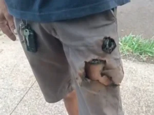 موبائل فون نے شہری کو کتے کے حملے سے بچا لیا