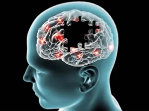 الزائمرز کے خلاف بڑی پیشرفت، نئی دوا نے سائنس دانوں کو پُرامید کر دیا