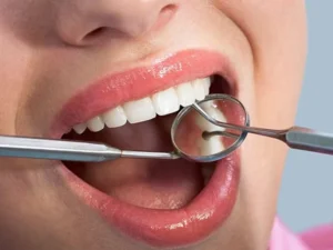 مسوڑھوں سے خون آنا کس خطرناک بیماری کی علامت ہو سکتا ہے؟